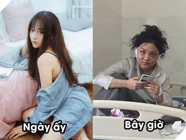 Cộng đồng choáng váng khi thấy hình ảnh Kiều Anh Hera hiện tại trông na ná... Vinh Râu - Ảnh 2. Cộng đồng choáng váng khi thấy hình ảnh Kiều Anh Hera hiện tại trông na ná... Vinh Râu - Ảnh 2.