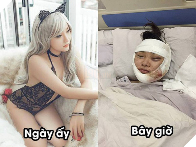 Cộng đồng choáng váng khi thấy hình ảnh Kiều Anh Hera hiện tại trông na ná... Vinh Râu - Ảnh 3. Cộng đồng choáng váng khi thấy hình ảnh Kiều Anh Hera hiện tại trông na ná... Vinh Râu - Ảnh 3.