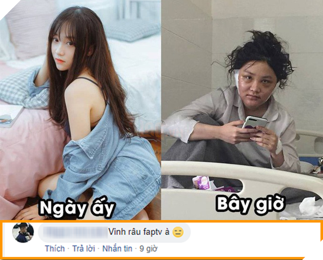 Cộng đồng choáng váng khi thấy hình ảnh Kiều Anh Hera hiện tại trông na ná... Vinh Râu - Ảnh 4. Cộng đồng choáng váng khi thấy hình ảnh Kiều Anh Hera hiện tại trông na ná... Vinh Râu - Ảnh 4.
