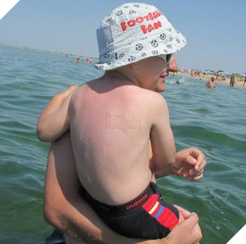 Cậu bé có gương mặt của một ông lão. (Ảnh: Internet)