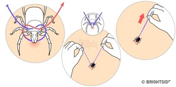 Cách xử lí khi bọ chét bám trên cơ thể.