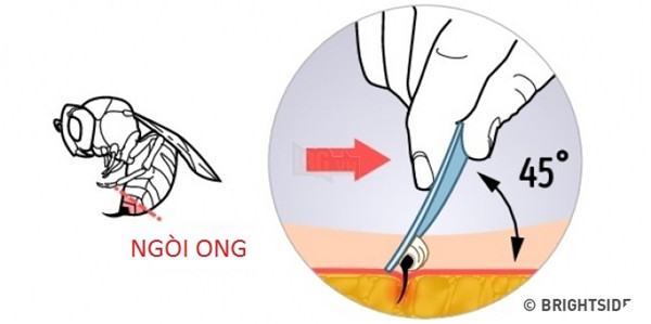 Cách sơ cứu khi bị ong đốt.