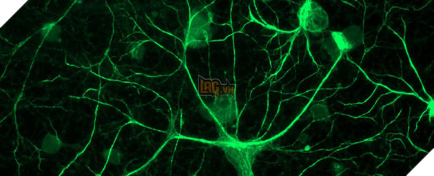 
Căn bệnh “không có trí tưởng tượng” có thể ngăn chặn chức năng dự đoán này của não bộ.
