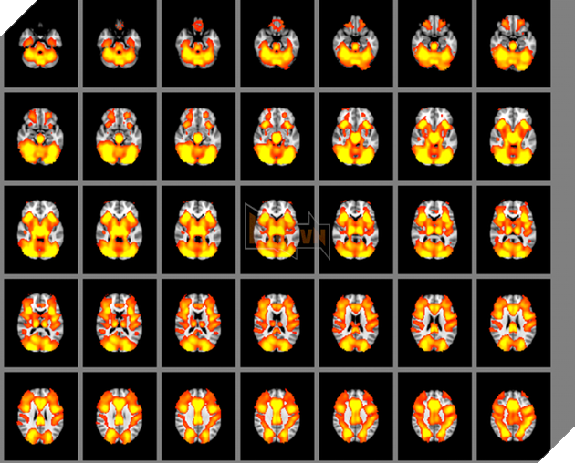 Nếu nói với bố mẹ rằng "chơi game khiến đầu óc con thông minh hơn" thì bạn đã dối trá 100% rồi đấy