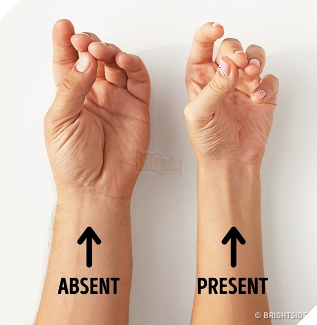 9 đặc điểm cho thấy bạn có một cơ thể đặc biệt hơn người bình thường 8