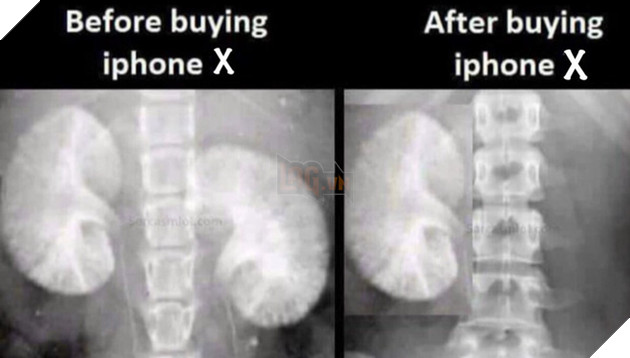 
Trước khi mua iPhone X và sau khi mua iPhone X.
