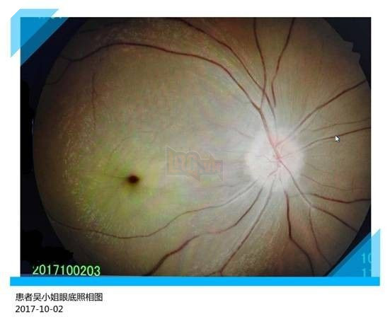 Cắm mặt cày game điện thoại suốt một ngày, cô gái trẻ không ngờ bị mù luôn một mắt - Ảnh 1.