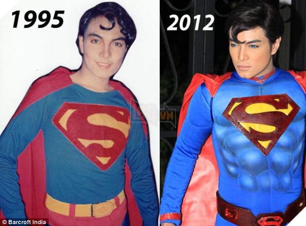 Chàng trai người Philippines vung tiền thẩm mỹ để giống hệt Superman, chỉ thiếu mỗi nước học bay - Ảnh 5. Chàng trai người Philippines vung tiền thẩm mỹ để giống hệt Superman, chỉ thiếu mỗi nước học bay - Ảnh 5.
