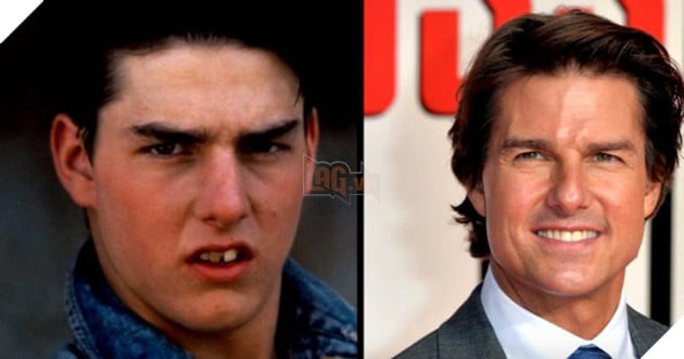 Tom Cruise