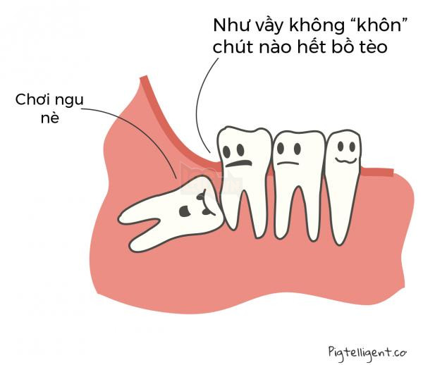 the-way-of-a-wisdom-tooth-01 the way of a wisdom tooth 01