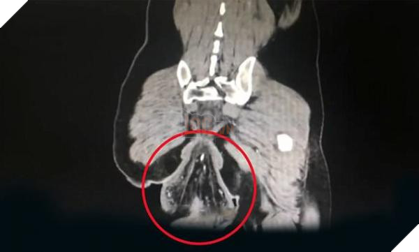 truc trang 1 15184535852831984081010