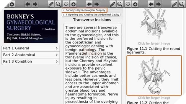 Bonney's Gyn. Surgery, 11th Edition