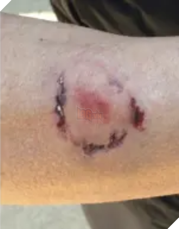 Ẩu đả oái oăm: Cô gái xịt hơi cay vào chó dữ, bị chủ chó chặn đường cắn chảy máu tay trả thù - Ảnh 1.