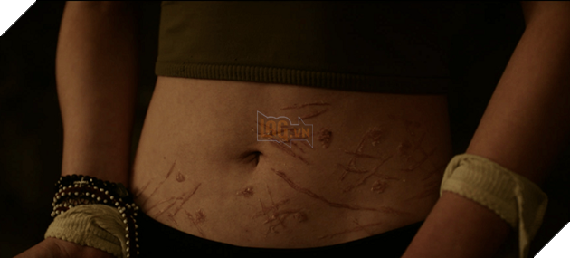 Nhung-vet-bam-tren-co-the-Casey-do-nguoi-chu-bao-hanh-tu-nho