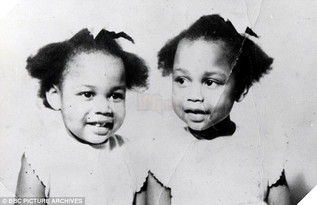 Đáng sợ với những quan hệ tâm linh giữa những cặp song sinh 2