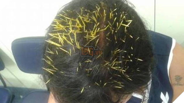 Chó nghiệp vụ nhập viện khẩn cấp vì bị nhím cắm hơn 200 gai lên mặt 4
