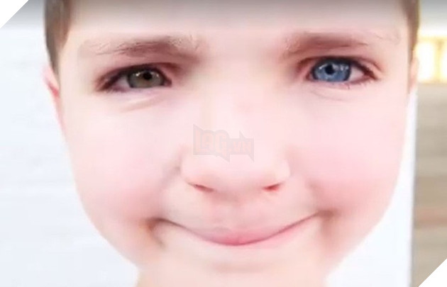 Cùng màu mắt, cùng bị tật ở miệng, số phận đã an bài cho cậu bé đáng thương và chú mèo hoang trở thành tri kỷ - Ảnh 7.