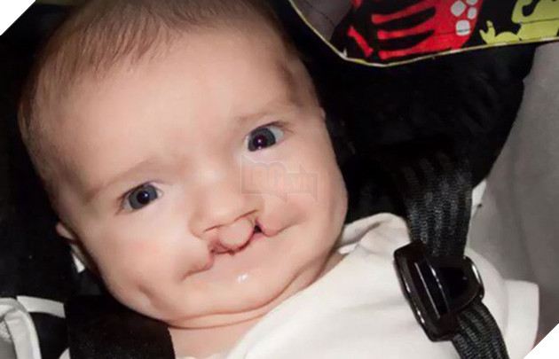 Cùng màu mắt, cùng bị tật ở miệng, số phận đã an bài cho cậu bé đáng thương và chú mèo hoang trở thành tri kỷ - Ảnh 8.