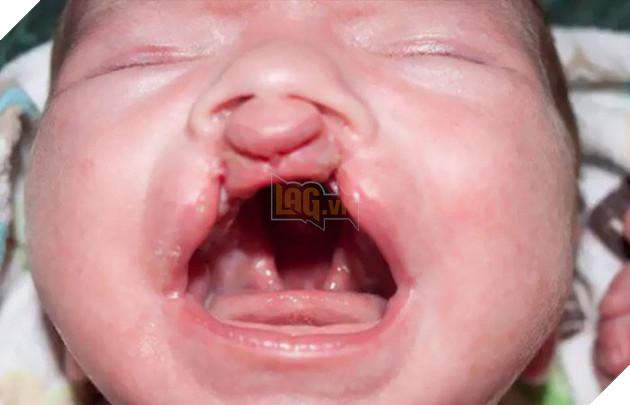 Cùng màu mắt, cùng bị tật ở miệng, số phận đã an bài cho cậu bé đáng thương và chú mèo hoang trở thành tri kỷ - Ảnh 9.