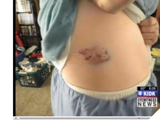 Một chú mèo đã cắn xé cào cấu người chủ của mình vì không cho nó ra ngoài rượt trai 4