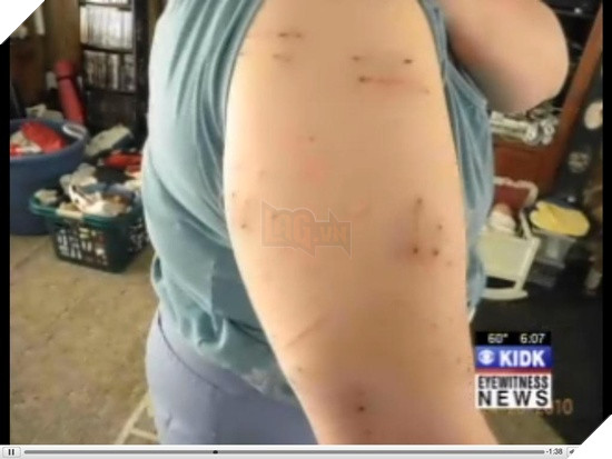 Một chú mèo đã cắn xé cào cấu người chủ của mình vì không cho nó ra ngoài rượt trai 3