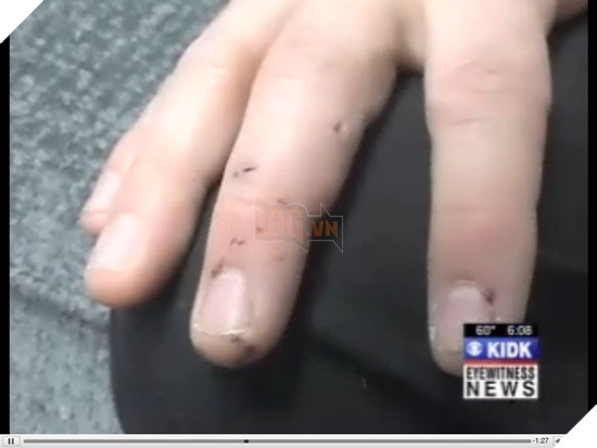 Một chú mèo đã cắn xé cào cấu người chủ của mình vì không cho nó ra ngoài rượt trai 5