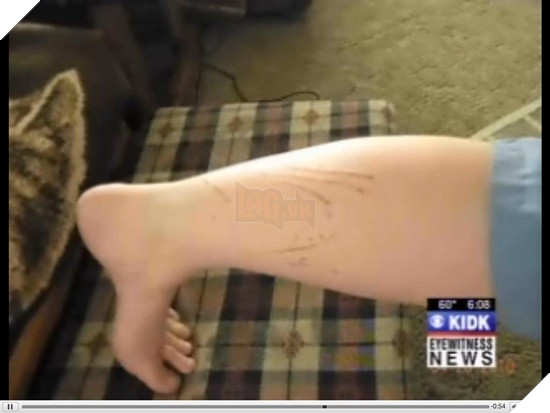 Một chú mèo đã cắn xé cào cấu người chủ của mình vì không cho nó ra ngoài rượt trai 6