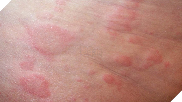 Y&#234;u m&#232;o đến đi&#234;n dại m&#224; ở gần l&#224; ngứa hết cả người? Bi kịch của c&#225;c &quot;sen&quot; nay sắp chấm dứt rồi - Ảnh 1.