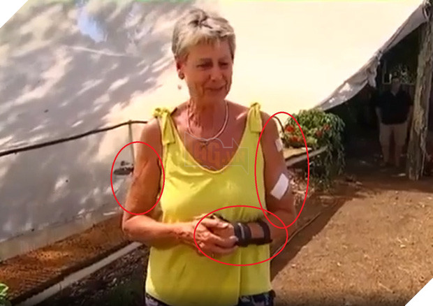 Con kangaroo hồn nhiên vào nhà dân ăn vụng rồi còn đấm người đến mức phải nhập viện vì gãy cổ tay - Ảnh 2.