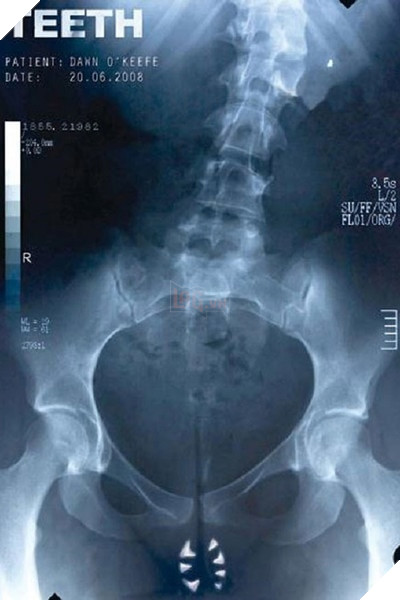 Những poster phim bị cấm gây chấn động điện ảnh thế giới P2  8