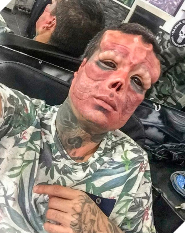 Màn cosplay Red Skull kinh dị nhất: Người đàn ông khiến dân tình rùng mình khi cắt mũi, cấy ghép sừng... 3