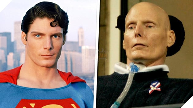 Điểm anh dàn sao từng chiến thắng bệnh tật để toả sáng P1  4