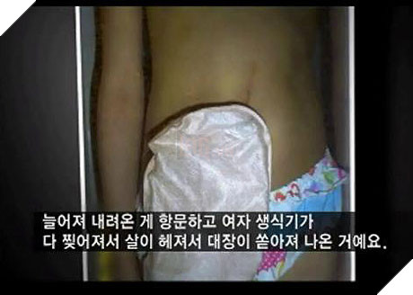 Cuộc sống của Nayoung - nạn nhân nguyên mẫu phim Hope bây giờ ra sao? 2