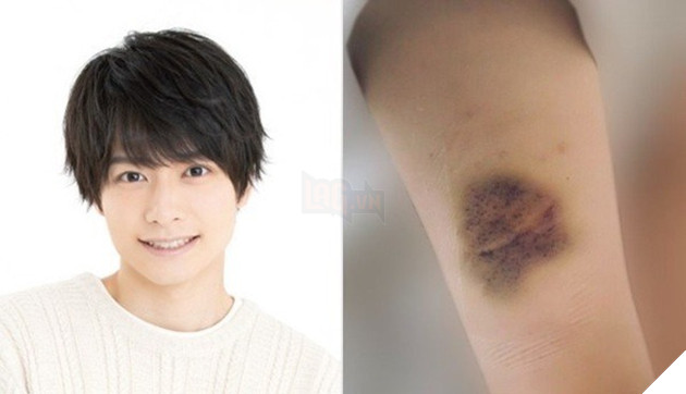 Nam thần Nhật Bản bị tố bạo lực tình dục, đánh bạn gái đến xảy thai là ai? 