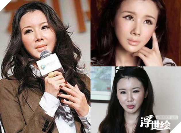 Bi kịch đằng sau những mỹ nhân Trung Hoa phẫu thuật thẩm mỹ hỏng 8