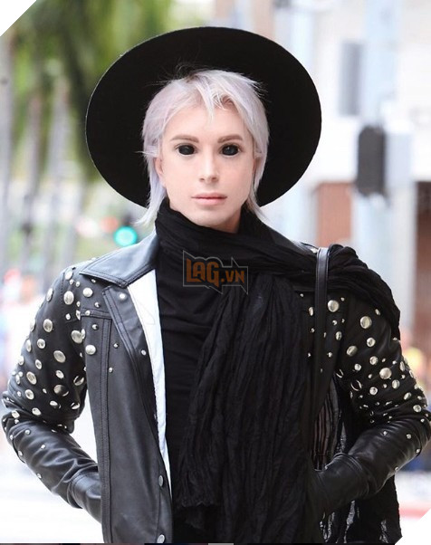  Chuyện kinh dị có thật Chàng trai chi hàng tỷ đồng và phẫu thuật hơn 32 lần để cosplay yêu tinh đời thực  5