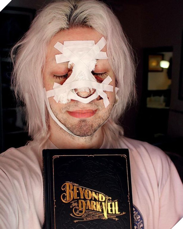  Chuyện kinh dị có thật Chàng trai chi hàng tỷ đồng và phẫu thuật hơn 32 lần để cosplay yêu tinh đời thực  3