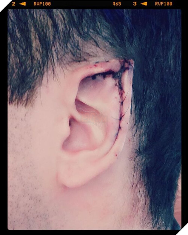  Chuyện kinh dị có thật Chàng trai chi hàng tỷ đồng và phẫu thuật hơn 32 lần để cosplay yêu tinh đời thực  2