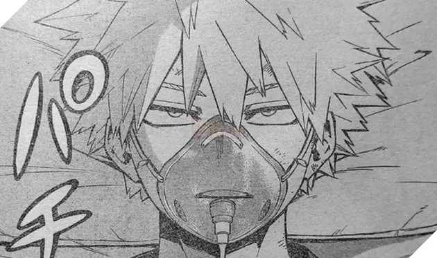 Spoiler My Hero Academia chap 298: Bakugo, Todoroki tỉnh lại sau trận chiến nhưng Deku thì... 2