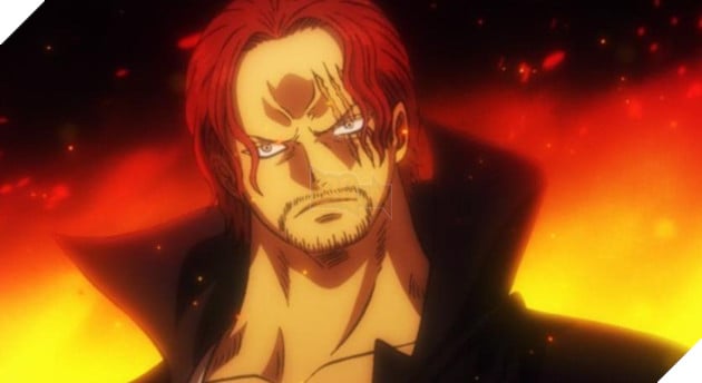 shanks