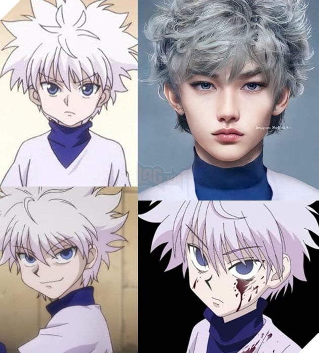 killua người thật