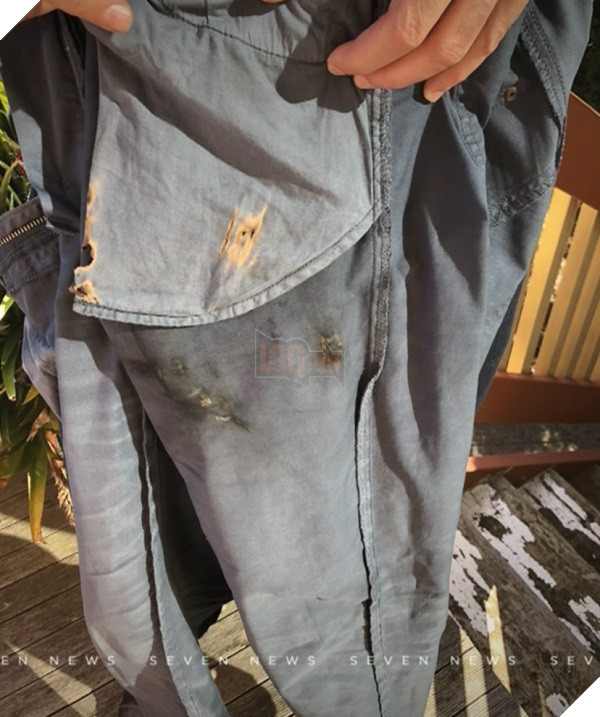 Người đàn ông kiện Apple sau khi iPhone X phát nổ trong túi của anh ấy tại nơi làm việc 2