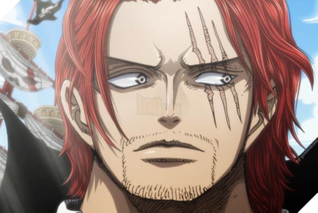 Shanks