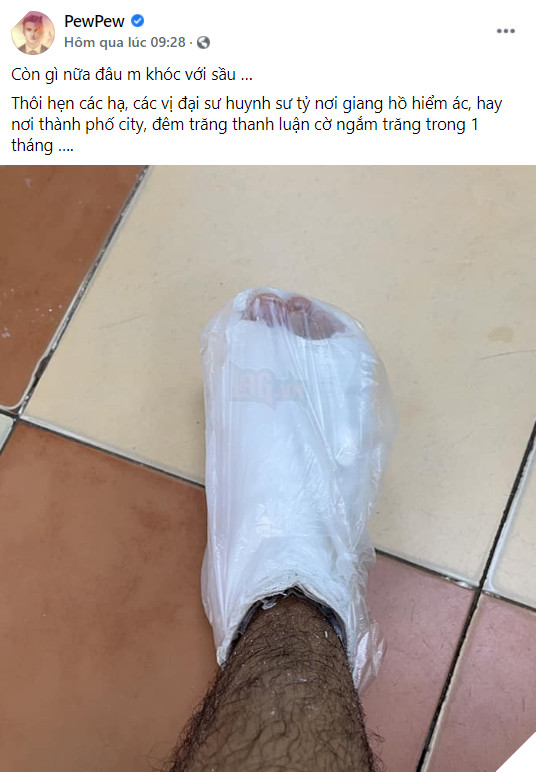 PewPew bất ngờ bị chấn thương chân phải nghỉ stream, cộng đồng vừa buồn cười vừa thương khi biết lý do 2