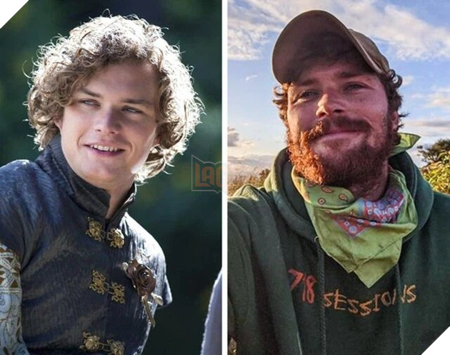 Những ngôi sao Game Of Thrones ngày ấy - bây giờ P2  4