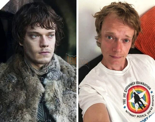 Những ngôi sao Game Of Thrones ngày ấy - bây giờ P3  3