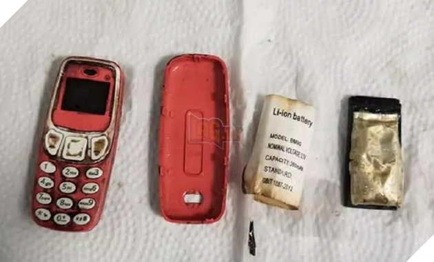 Một người đàn ông yêu cầu phẫu thuật sau khi nuốt nhầm chiếc điện thoại di động