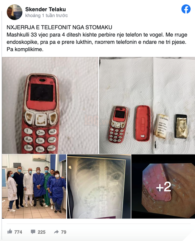 Một người đàn ông yêu cầu phẫu thuật sau khi nuốt nhầm chiếc điện thoại di động 2