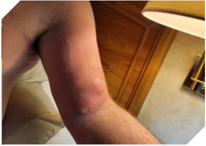 Tai nạn khác tại phim trường Rust sau vụ diễn viên bắn chết người khiến dân tình nổi gai óc 3