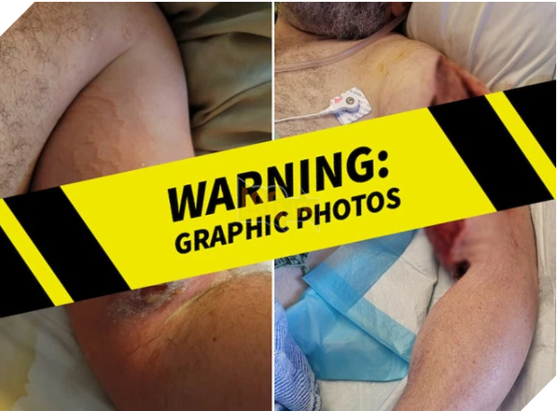 Tai nạn khác tại phim trường Rust sau vụ diễn viên bắn chết người khiến dân tình nổi gai óc 2